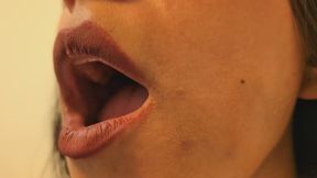 ORAL EXAMINATION: OPEN LIPS OF THE MOUTH | Laura