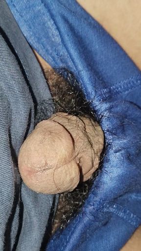 Acne on my penis I want to clean it up