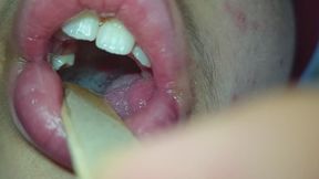 Dientes reales al desnudo: imperfecciones sin filtro.