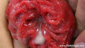 Hotkinkyjo deep anal&#x1F44C; insertion and intense prolapse sensations