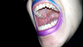 my bad breath