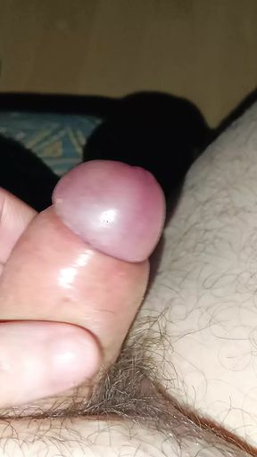 Penis with phimosis and after phimosis remove