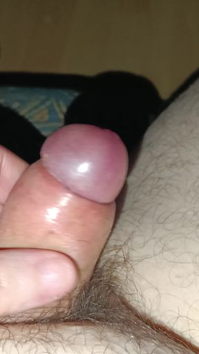 Penis with phimosis and after phimosis remove