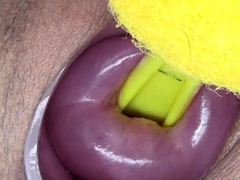 Lesbians Extreme Cervix Play and Peehole Fucking Penis Dildo