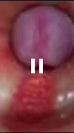 Best Compilation Crempie Pussy - Camera Inside 4K