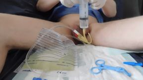 bladder lavage, 3-way catheter