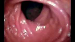 Anal adventure deep into her colon porn video
