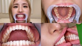 Riria Hyodo - Watching Inside mouth of Japanese cute girl - 1080p