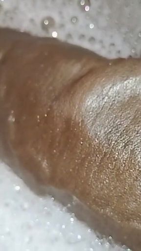 Thick Veins on Cms BBC