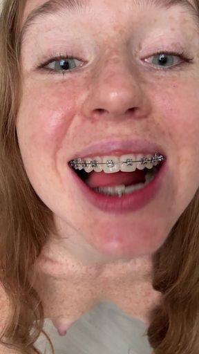 Teen GF shows off her shiny braces while sucking cock