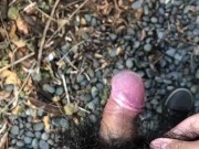 My little phimosis penis erects