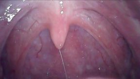 YAWNING MAGICIAN HARBOURED HIS TINY BODY INSIDE MY PUSSY - UVULA (NO SOUND)