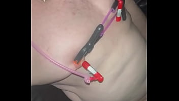 Extreme nipple pain