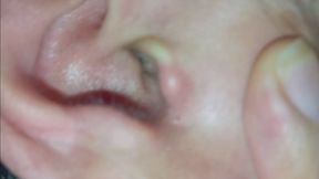 Ear Cleaning – Removing Built-Up Earwax