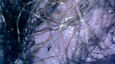 Hairy exploration peeing with endoscope on the toilet