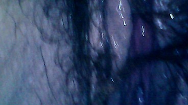 Hairy exploration peeing with endoscope on the toilet