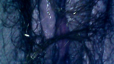 Hairy exploration peeing with endoscope on the toilet