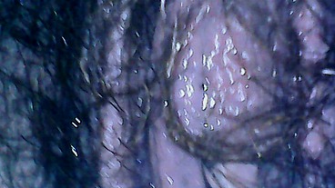 Hairy exploration peeing with endoscope on the toilet