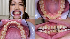 Minaho Ariga - Watching Inside mouth of Japanese cute girl - MOV 1080p