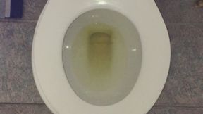I PEE GOLD IN MY TOILET MSN THE ZONE