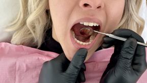Dental Cleaning - Full Mouth and Permanent Retainer