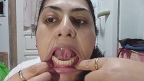 Revisión de dientes feos y limpieza de lengua.