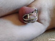 Prostate milking