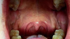 The Sounds of Digestion