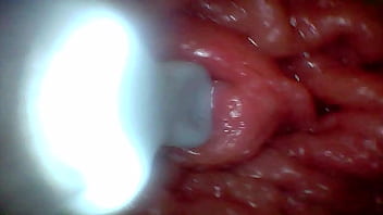 First time: An endoscope reveals the G-spot up close &ndash_ without mounting!