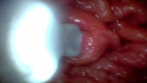 First time: An endoscope reveals the G-spot up close &ndash_ without mounting!