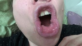 My morning bad breath and dirty tongue 2 bb