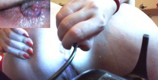 Medical Anal Endoscope Fisting and Extreme Masturbation