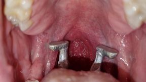 The male giant wants to swallow his two shrunken mates