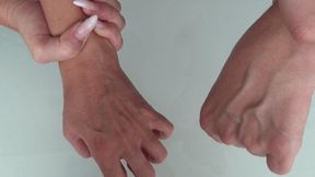 LARGE VEINS ON THE ARMS Ea