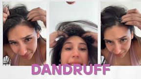 Dandruff Close-Up – Pure Visual Fetish