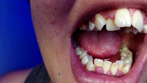 Brushing My Teeth and Showing You My Teeth (close-up)