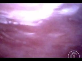 POV Extreme Deep Anal Exploration! Fast Visible Heartbeat