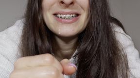 Handjob with BRACES , came too SOON on mouth! (dirty talking in German)