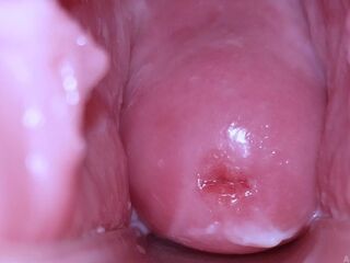 Cervix Display and Speculum Play