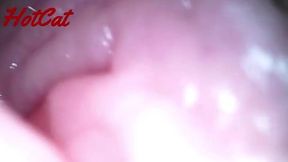 Intriguing Insights: Exploring the World of Endoscopic Observations