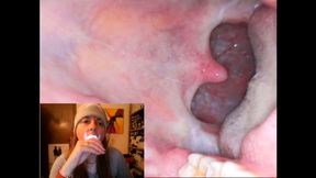 Endoscopy catarrh saliva and mouth exploration 1080HD