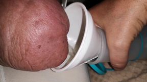 Urgently pissing while doing glucose session