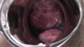 ”Hot Preggy Sexy Girl with male nurses & doc love to suck cocks.”