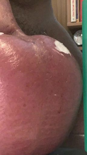 Must-share moment from &quot;Saline Glucose Infusion timelaps&quot;