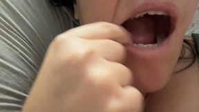 Buccal fistula - I need a root canal update (Aug 22 2025)