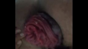 Extreme Anal Prolapse – Intense Gay Sex Pushing Limits
