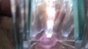 Speculum Spreading Pussy And Fingering