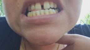 showing my yellow and disgusting teeth