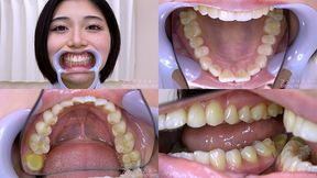 Inori Mano - Watching Inside mouth of Japanese cute girl - MOV