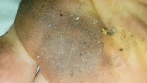 Lucys Dirty Feet Little Bonus)